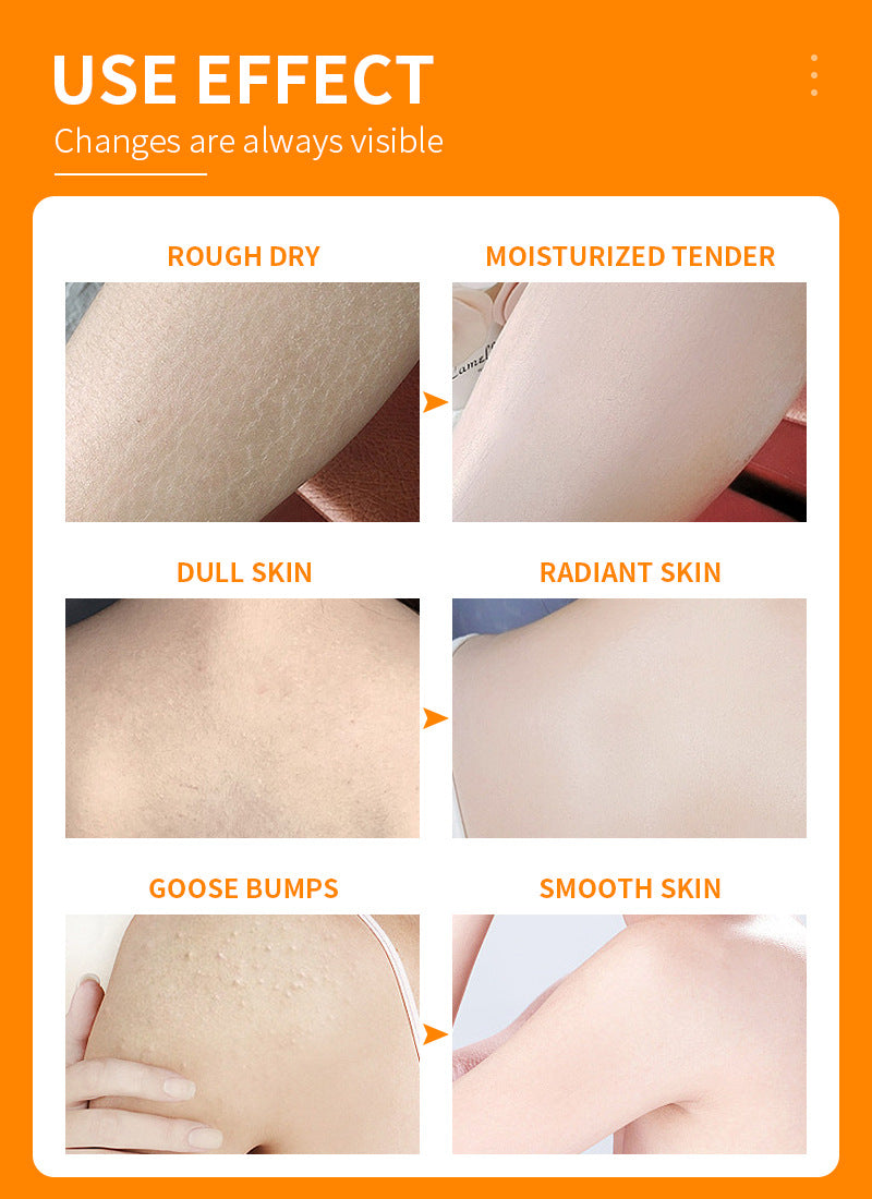 Vitamin C Body Lotion Moisturizing Brightening Skin Removing Chicken Skin